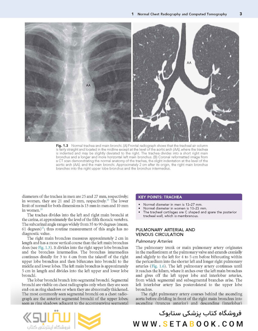 Muller’s Imaging of the Chest, 2nd Edition2018