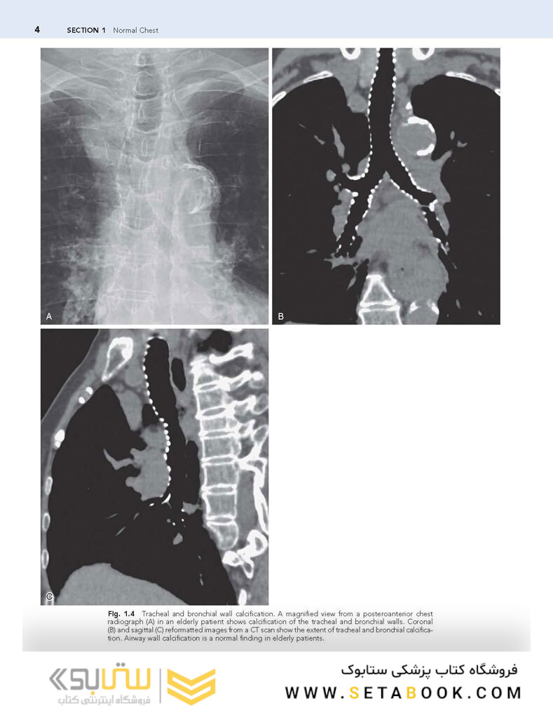 Muller’s Imaging of the Chest, 2nd Edition2018