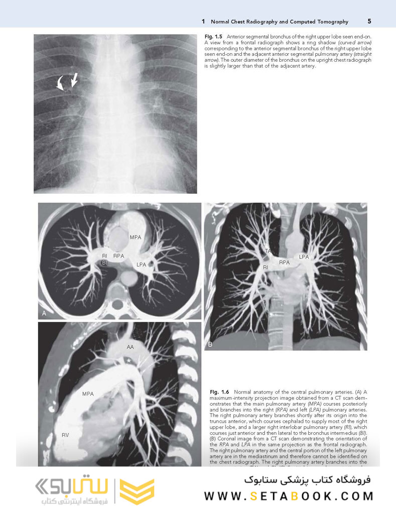 Muller’s Imaging of the Chest, 2nd Edition2018