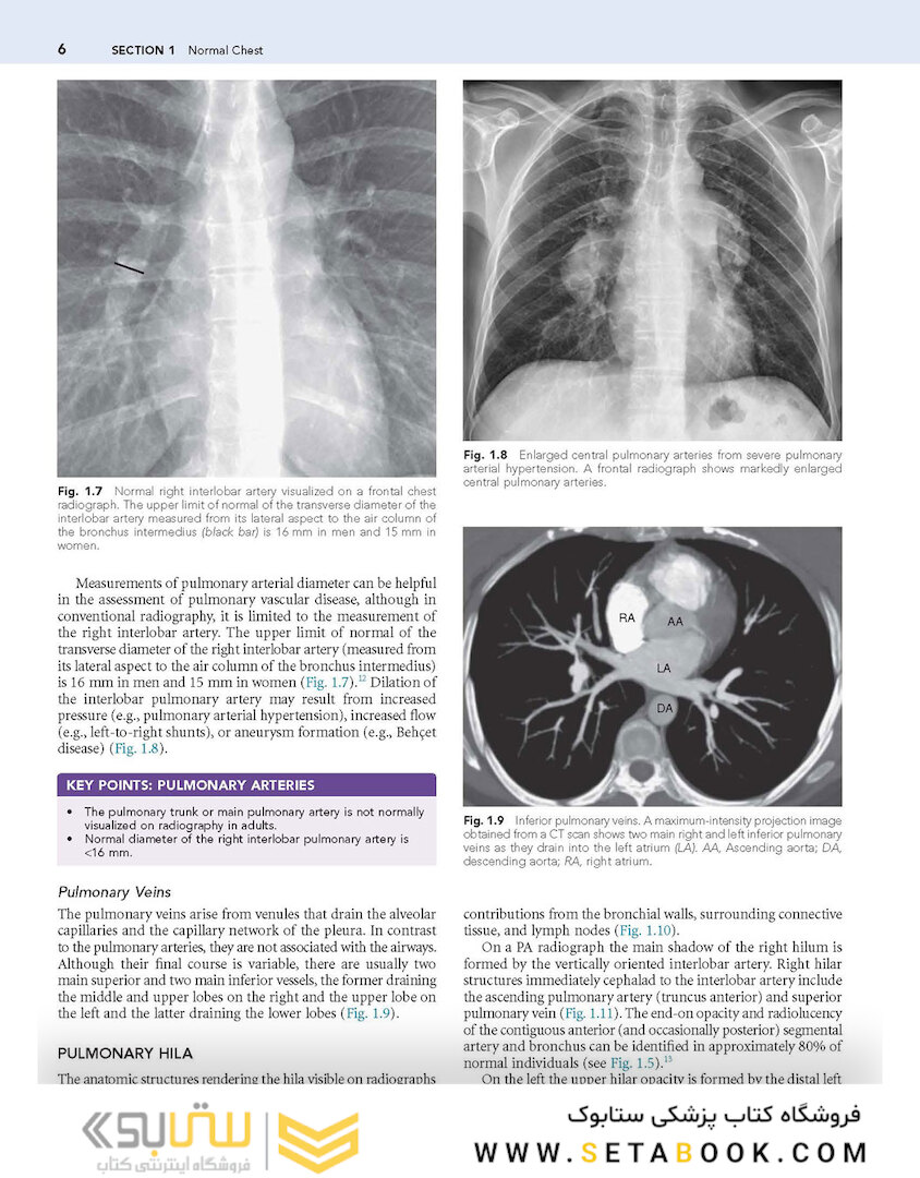 Muller’s Imaging of the Chest, 2nd Edition2018