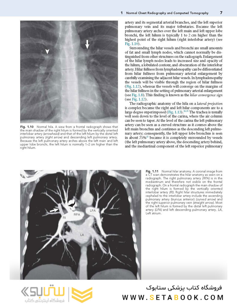 Muller’s Imaging of the Chest, 2nd Edition2018