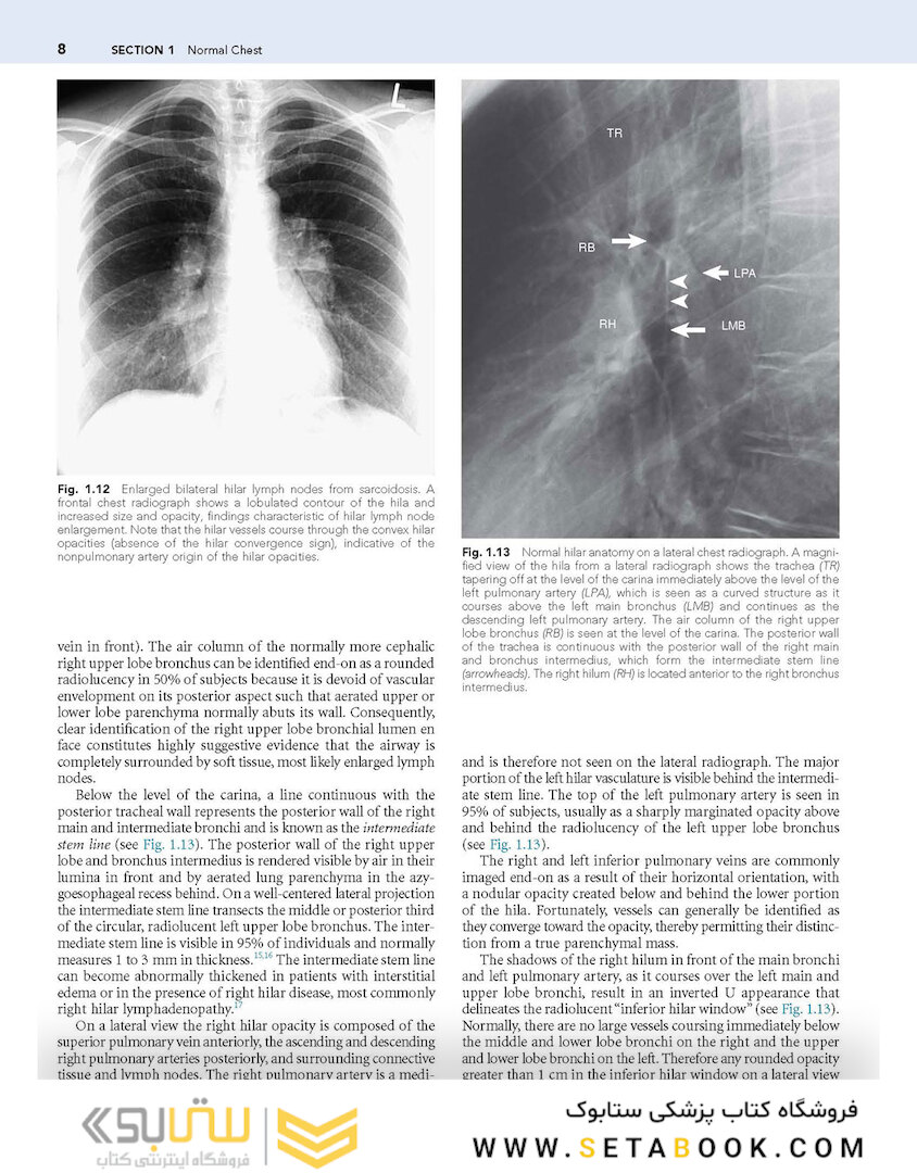 Muller’s Imaging of the Chest, 2nd Edition2018