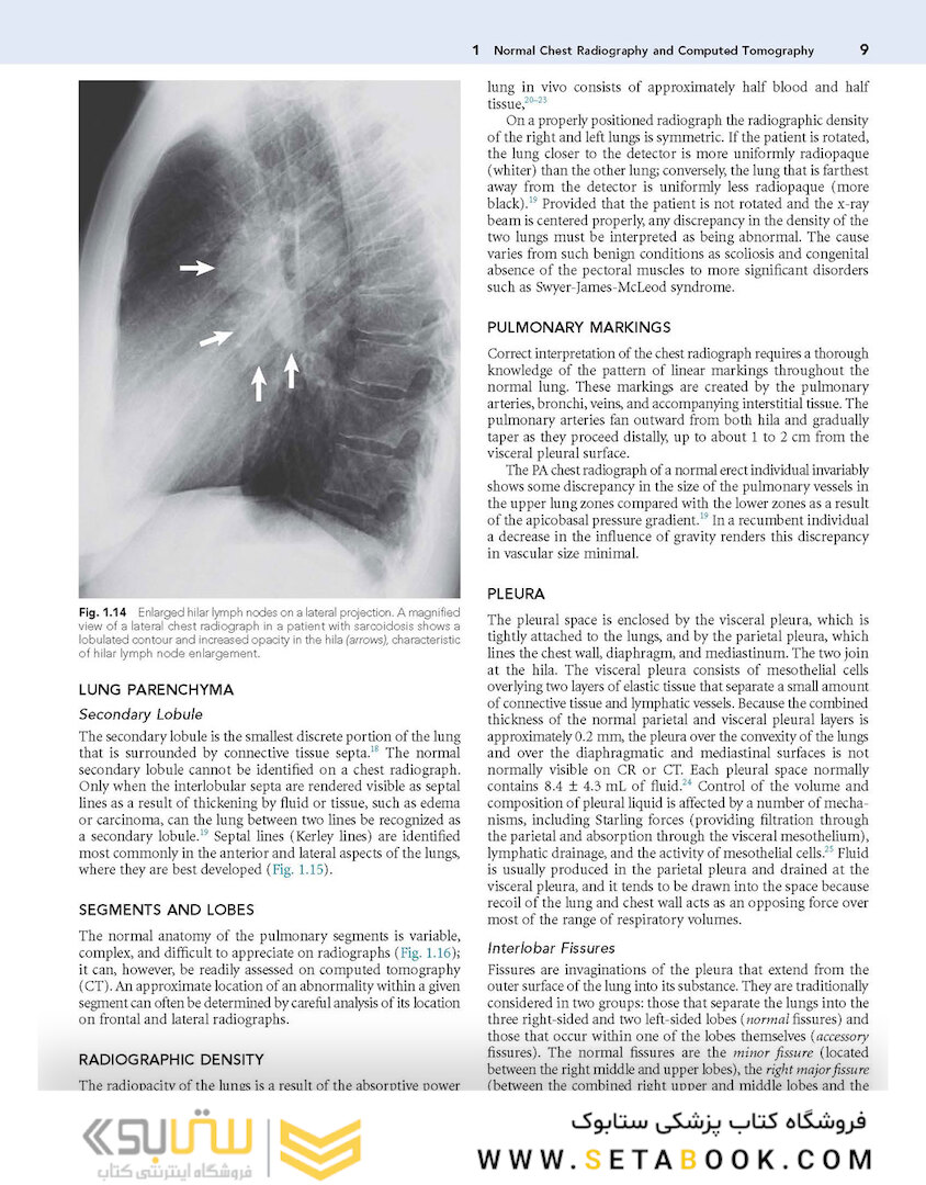 Muller’s Imaging of the Chest, 2nd Edition2018