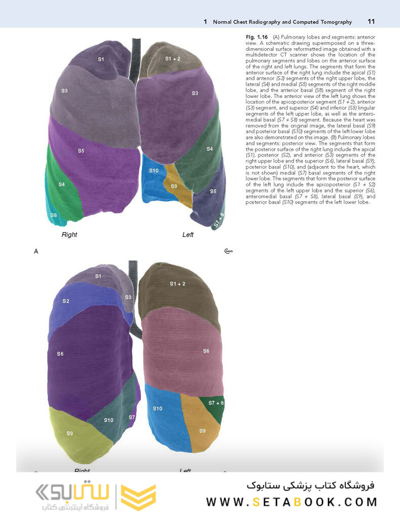 Muller’s Imaging of the Chest, 2nd Edition2018