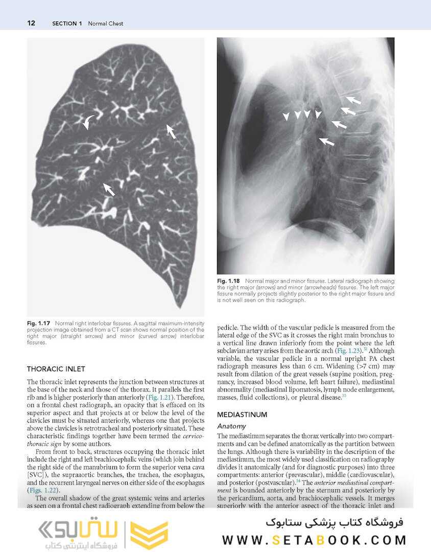 Muller’s Imaging of the Chest, 2nd Edition2018