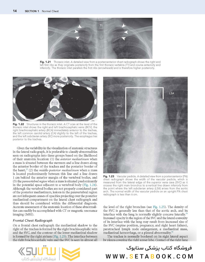 Muller’s Imaging of the Chest, 2nd Edition2018