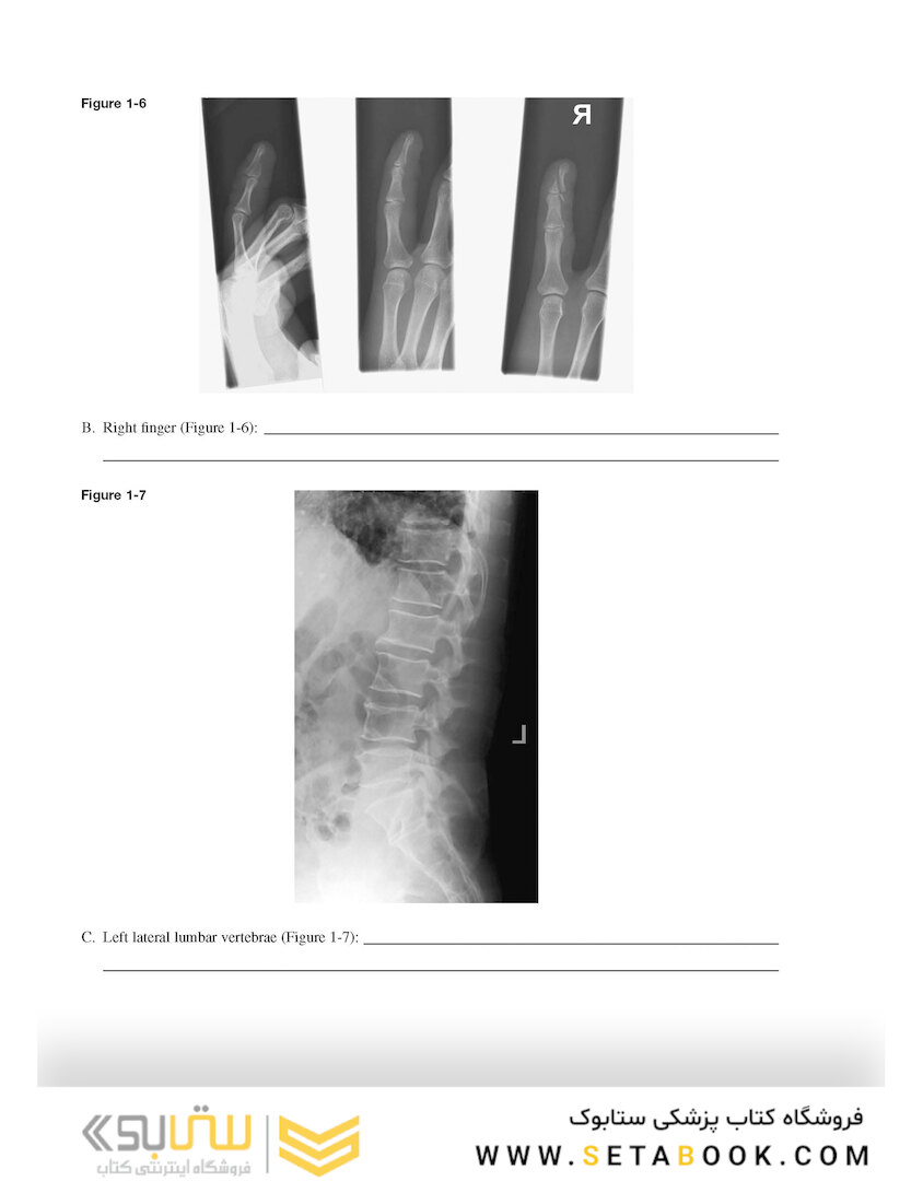 Workbook for Radiographic Image Analysis 5th Edicion