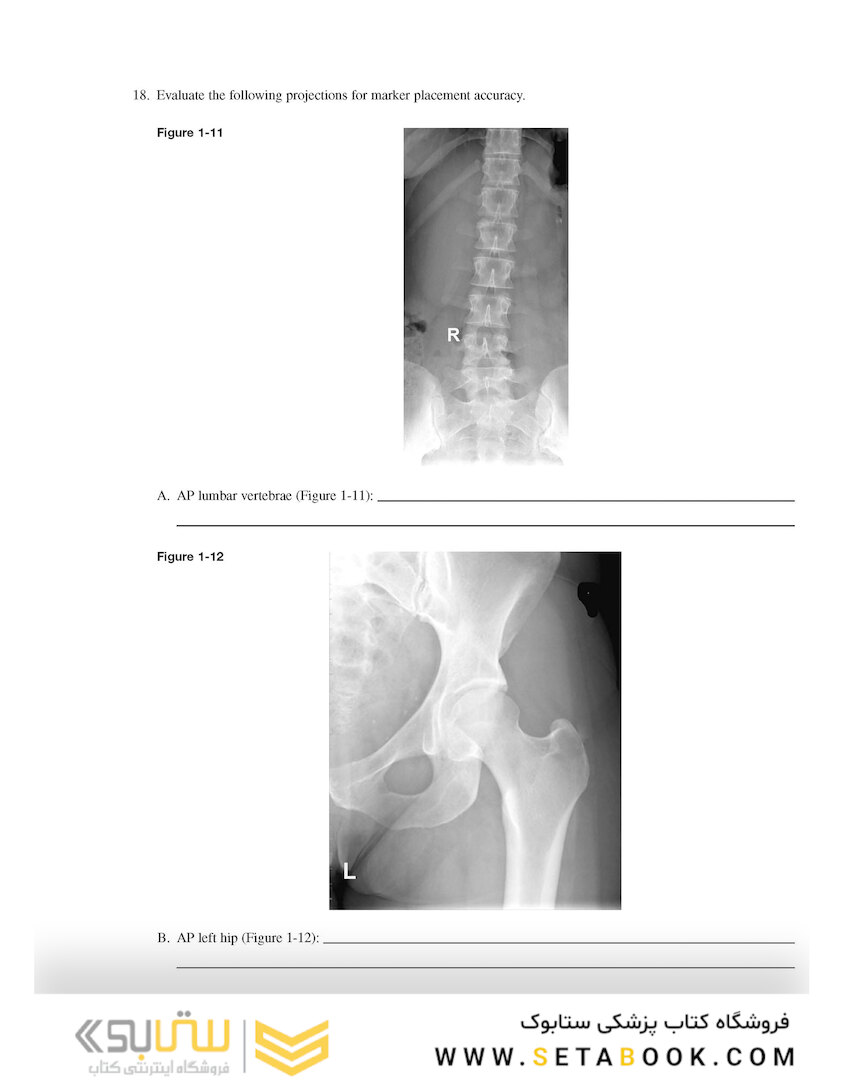 Workbook for Radiographic Image Analysis 5th Edicion