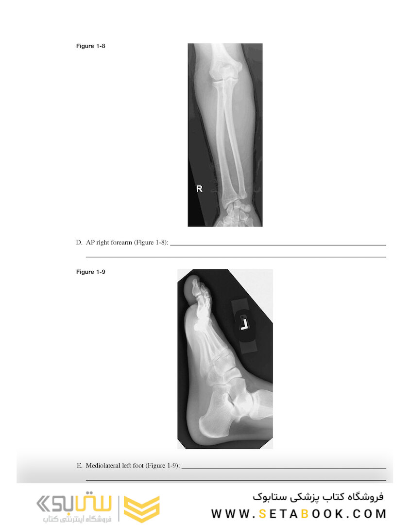 Workbook for Radiographic Image Analysis 5th Edicion
