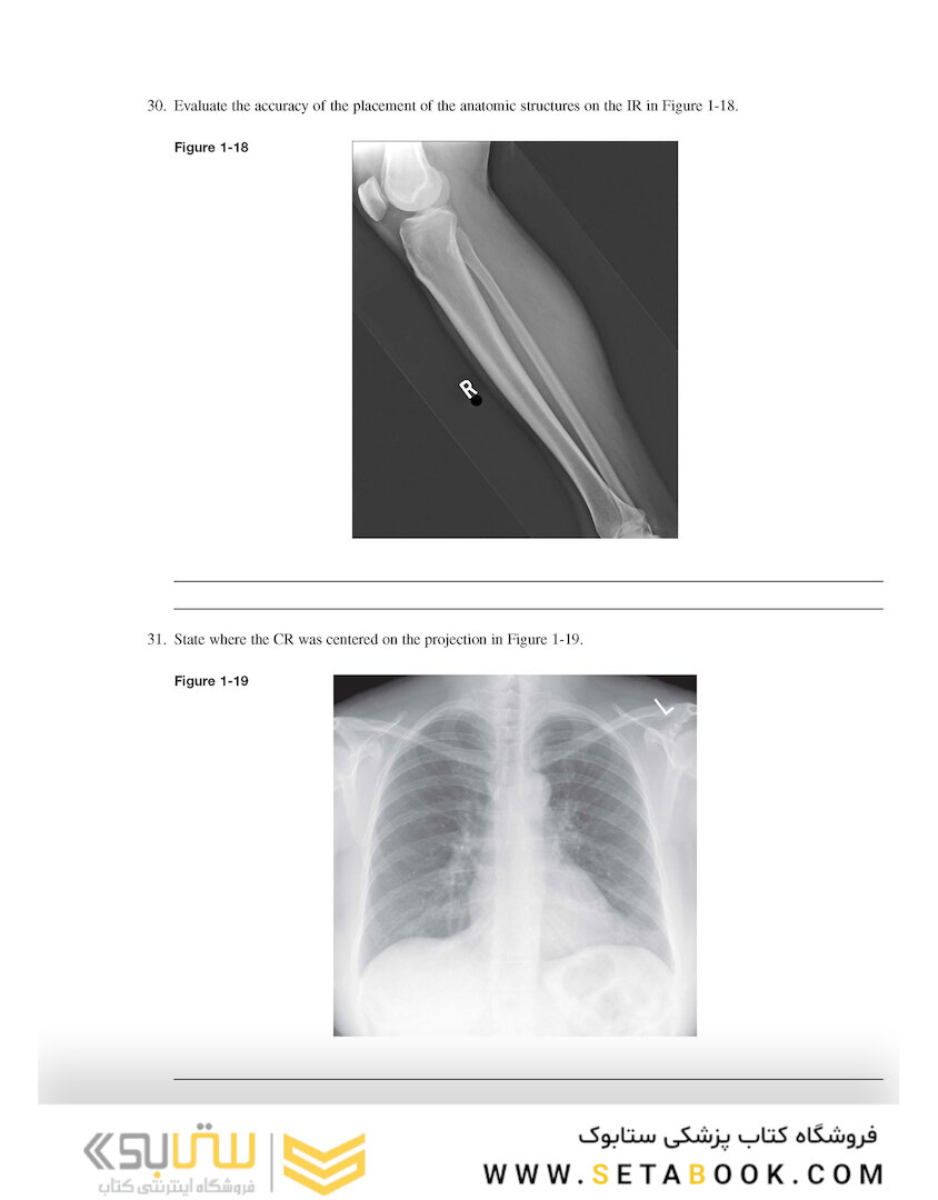 Workbook for Radiographic Image Analysis 5th Edicion