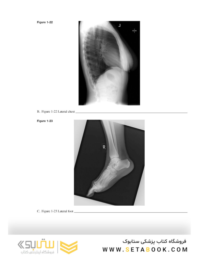 Workbook for Radiographic Image Analysis 5th Edicion