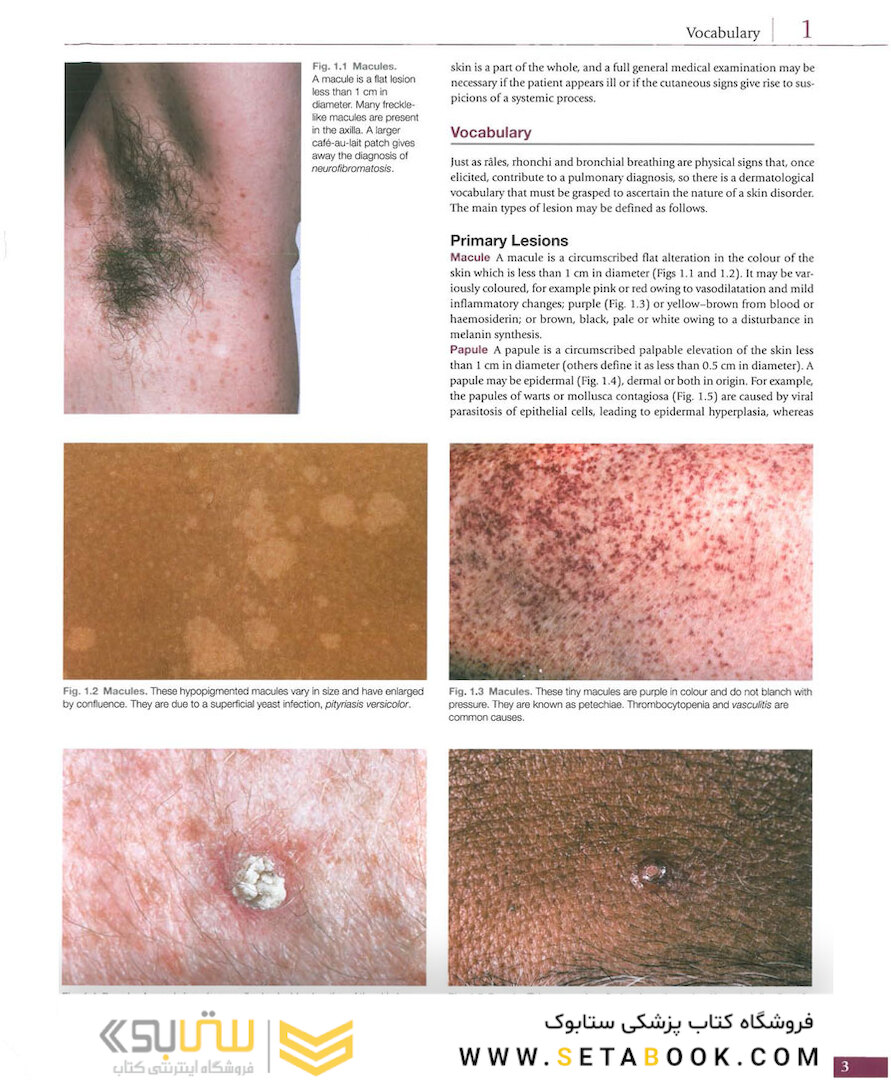 Atlas of Clinical Dermatology, 4th Edition