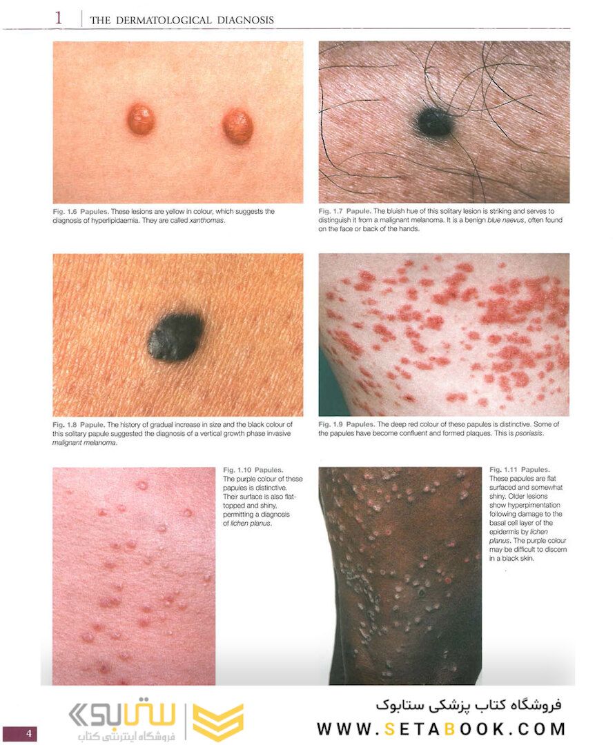 Atlas of Clinical Dermatology, 4th Edition