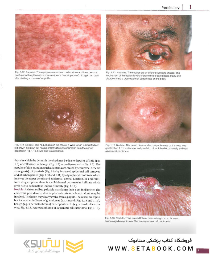 Atlas of Clinical Dermatology, 4th Edition