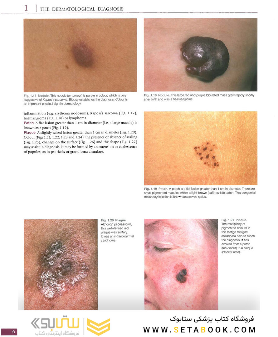Atlas of Clinical Dermatology, 4th Edition