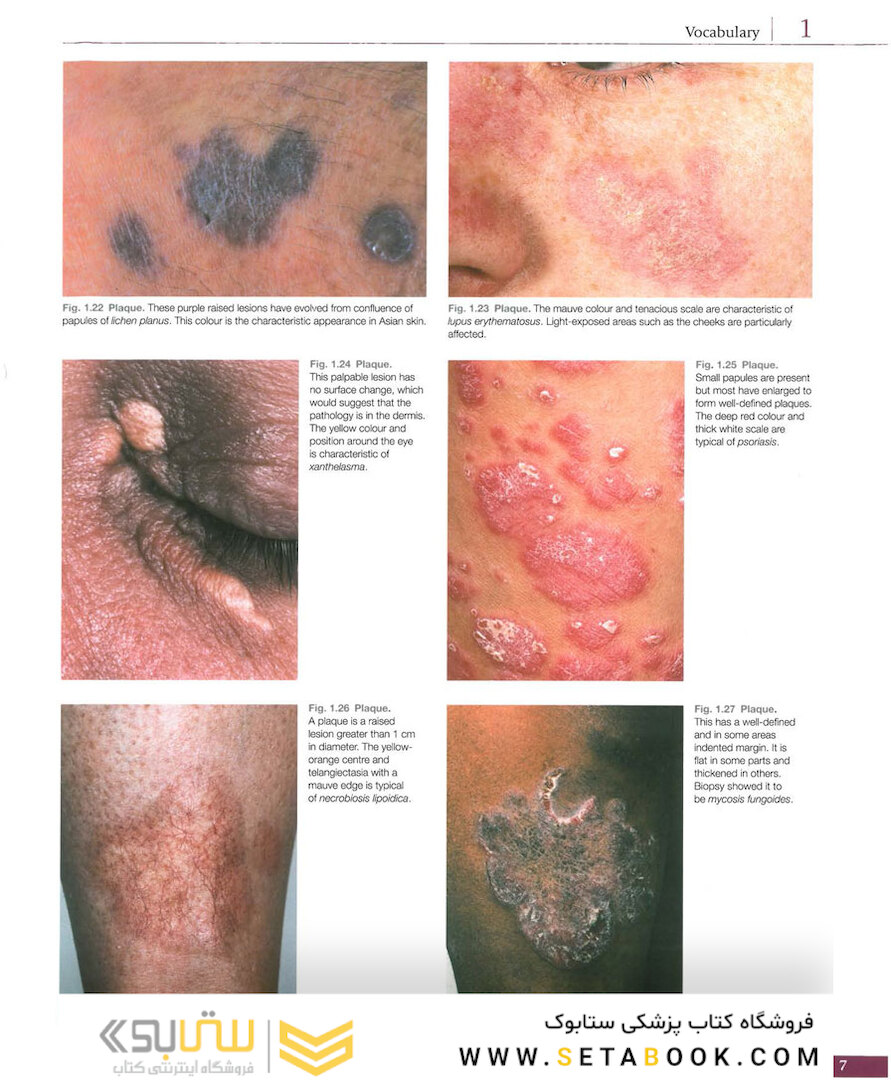 Atlas of Clinical Dermatology, 4th Edition