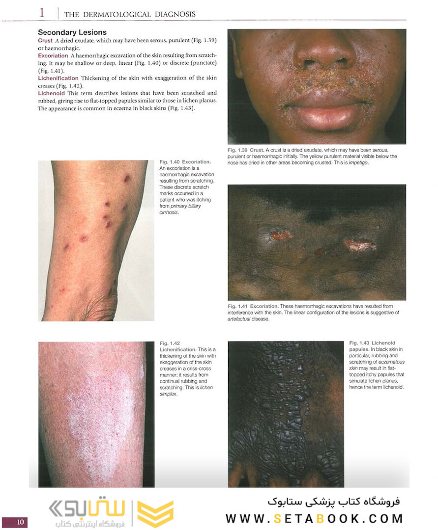 Atlas of Clinical Dermatology, 4th Edition