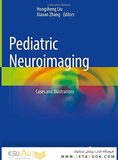Pediatric Neuroimaging: Cases and Illustrations 1st ed