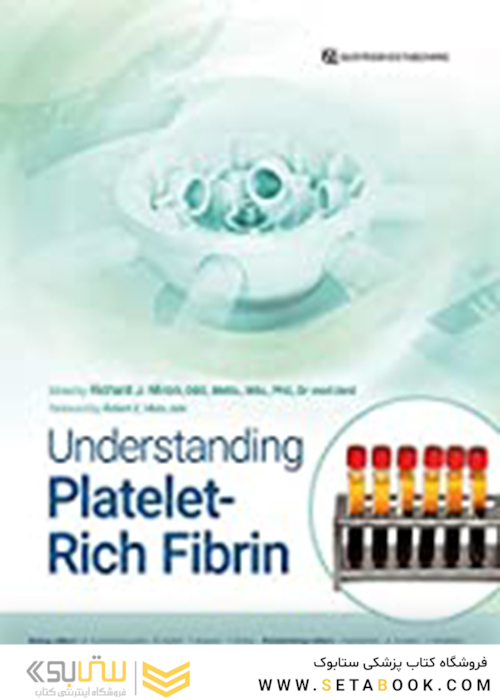 Understanding Platelet-Rich Fibrin2021