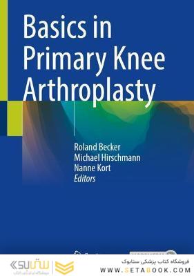 Basics in Primary Knee Arthroplasty