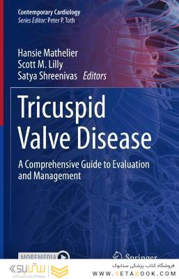Tricuspid Valve Disease: A Comprehensive Guide to Evaluation and Management (Contemporary Cardiology) 1st ed. 2022 Edition