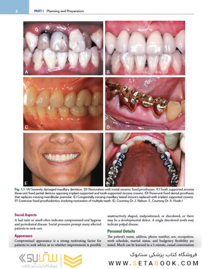 Contemporary Fixed Prosthodontics 6th Edition2023