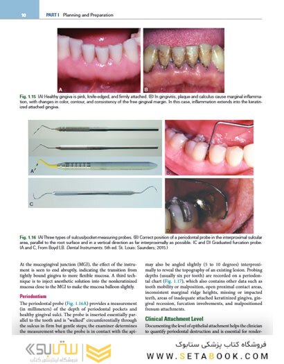 Contemporary Fixed Prosthodontics 6th Edition2023