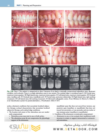 Contemporary Fixed Prosthodontics 6th Edition2023
