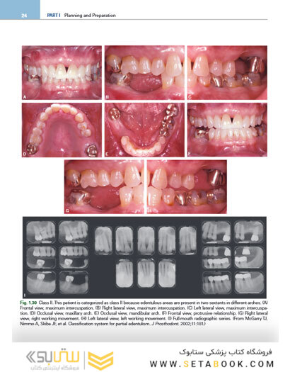 Contemporary Fixed Prosthodontics 6th Edition2023