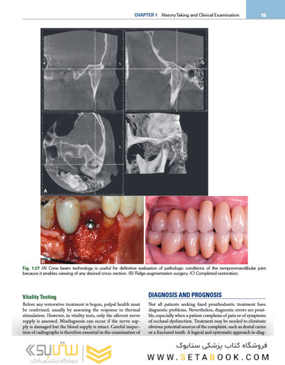 Contemporary Fixed Prosthodontics 6th Edition2023