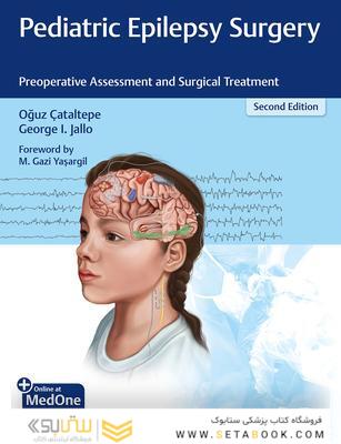 Pediatric Epilepsy Surgery : Preoperative Assessment and Surgical Treatment 2nd Edition