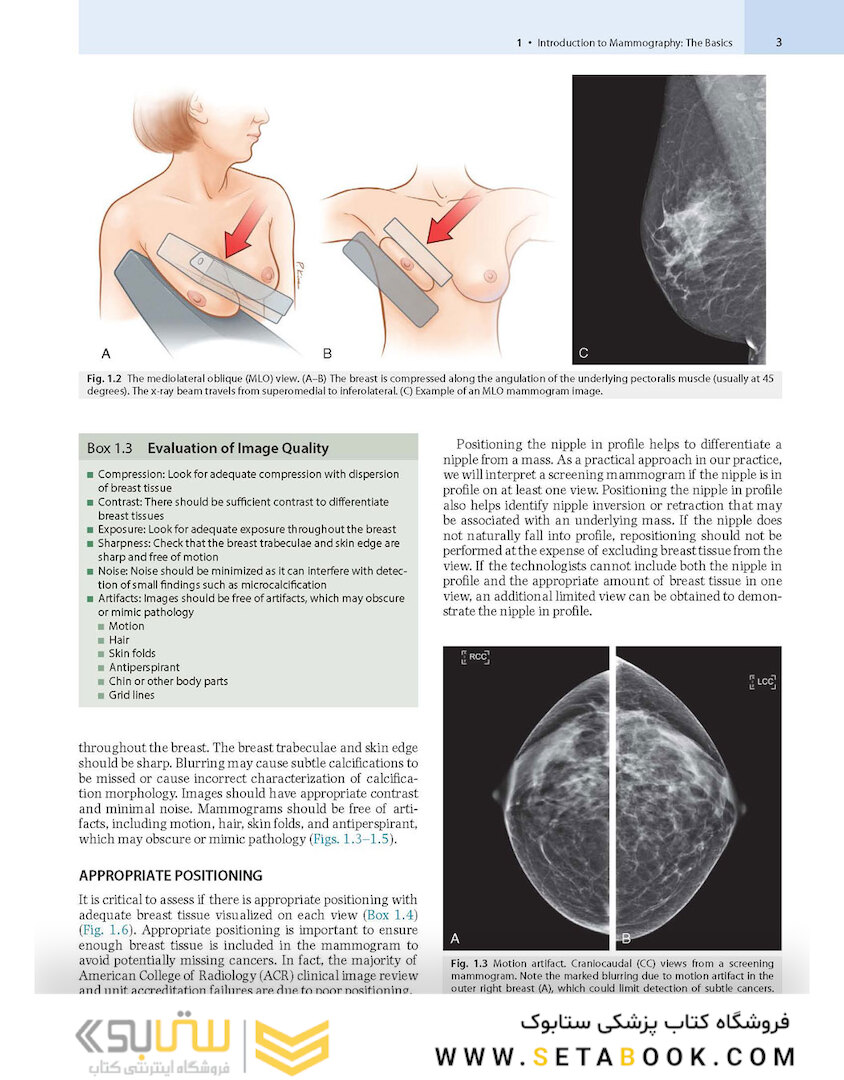 Breast Imaging : The Core Requisites 4th Edition