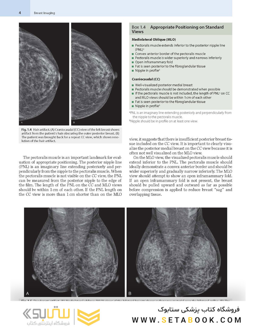 Breast Imaging : The Core Requisites 4th Edition