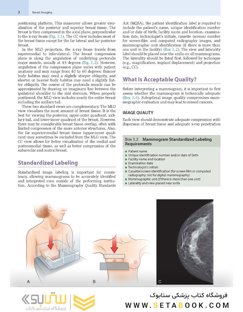 Breast Imaging : The Core Requisites 4th Edition