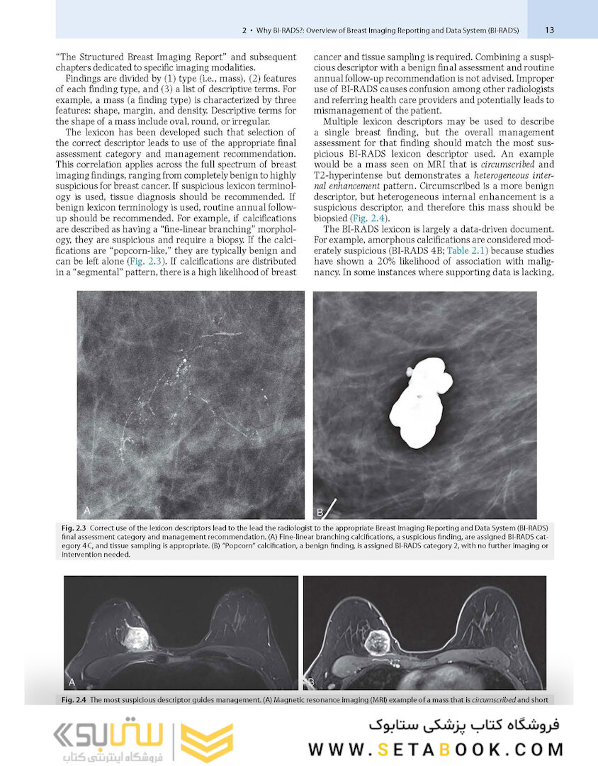 Breast Imaging : The Core Requisites 4th Edition