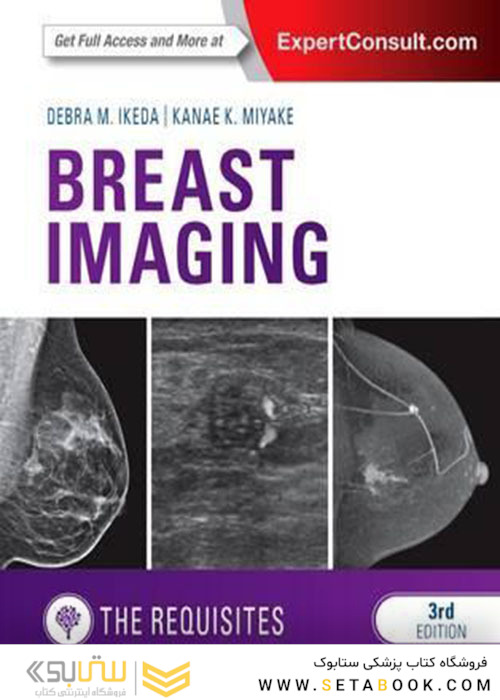 Breast Imaging: The Requisites