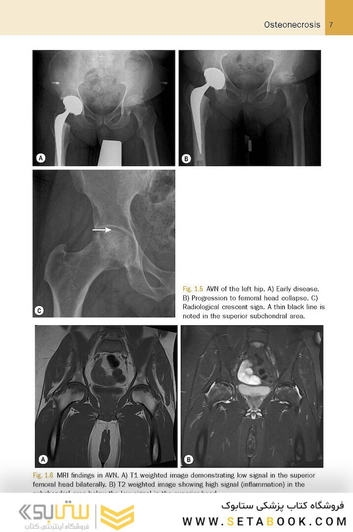 McRae’s Elective Orthopaedics 7th Edicion