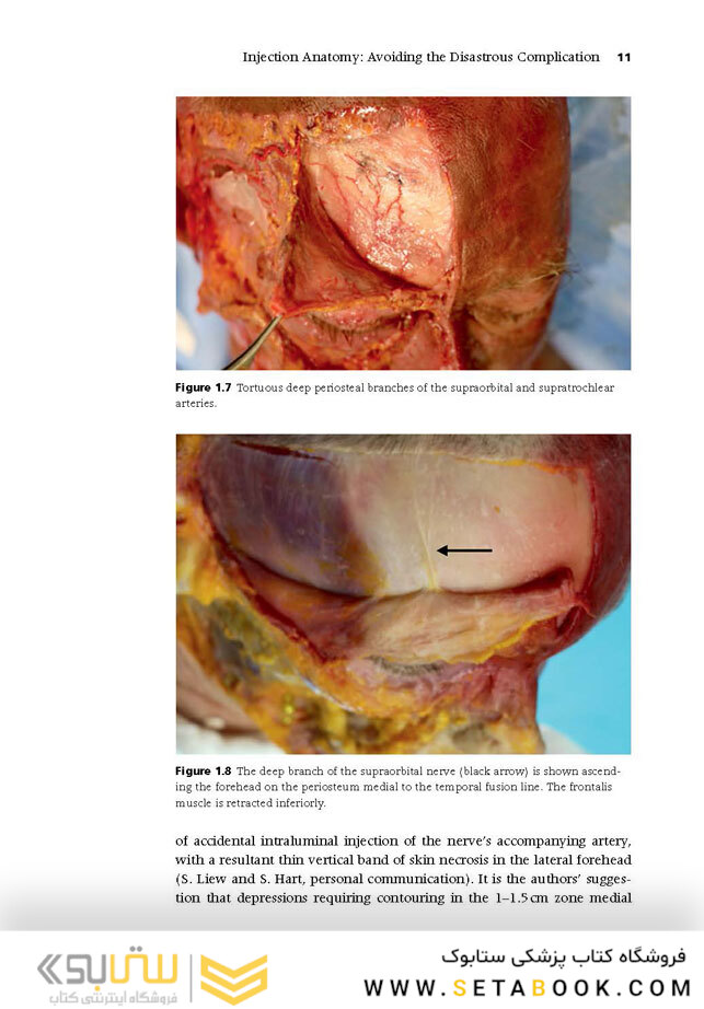 Injectable Fillers: Facial Shaping and Contouring 2nd Edition2019