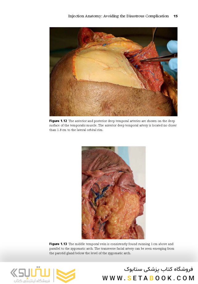 Injectable Fillers: Facial Shaping and Contouring 2nd Edition2019