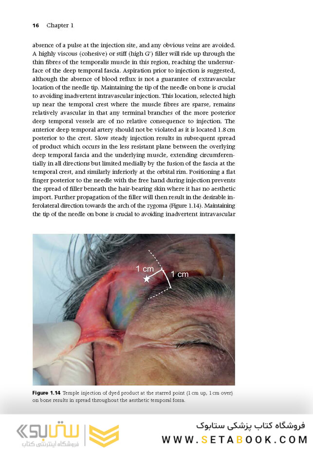 Injectable Fillers: Facial Shaping and Contouring 2nd Edition2019