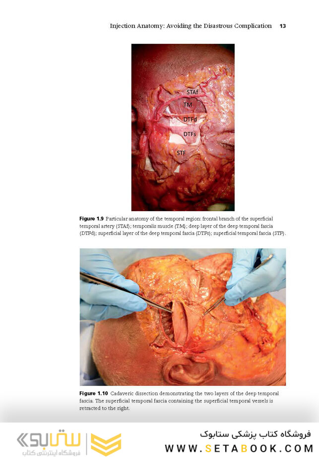 Injectable Fillers: Facial Shaping and Contouring 2nd Edition2019