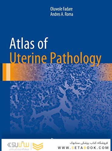 Atlas of Uterine Pathology (Atlas of Anatomic Pathology) 1st ed