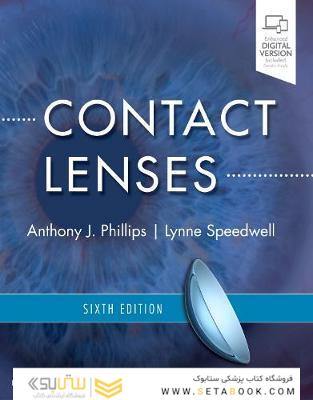 Contact Lenses, 6th Edition