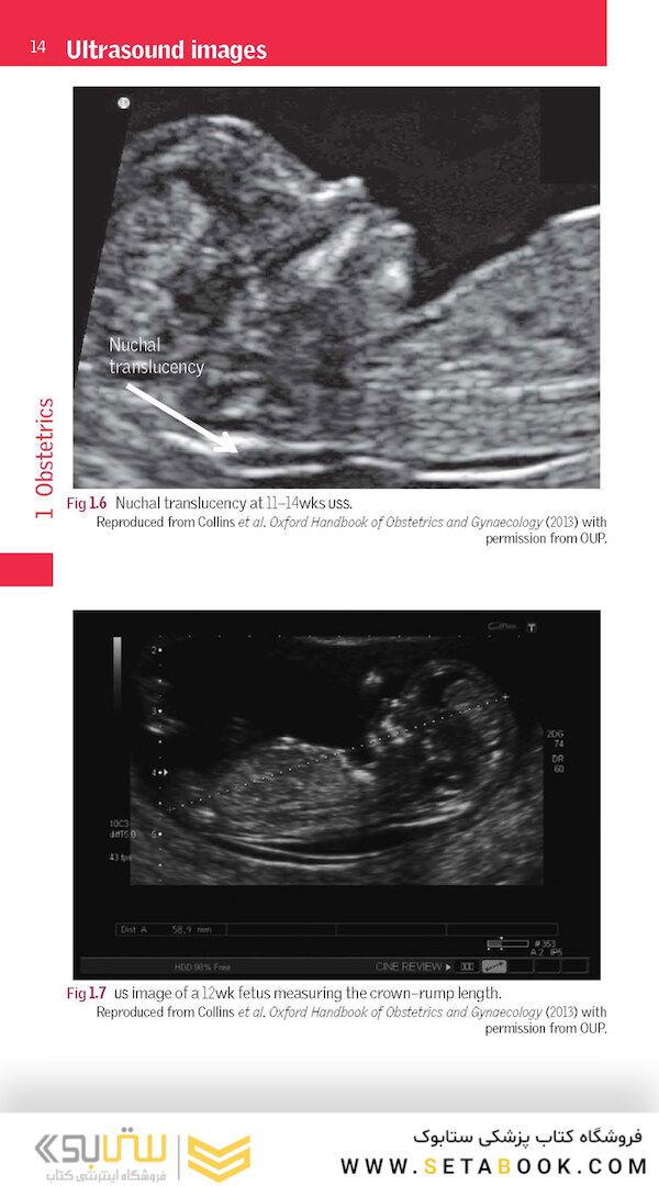 Oxford Handbook of Clinical Specialties, 11th Edition2020