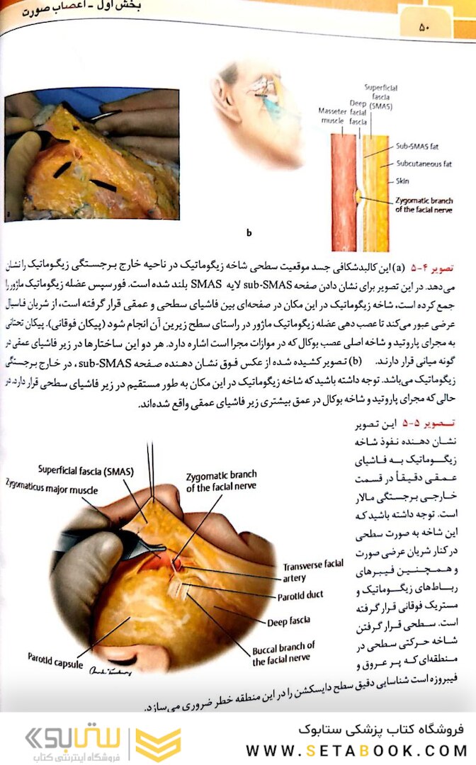 نواحی خطر صورت در پروسیجرهای زیبایی