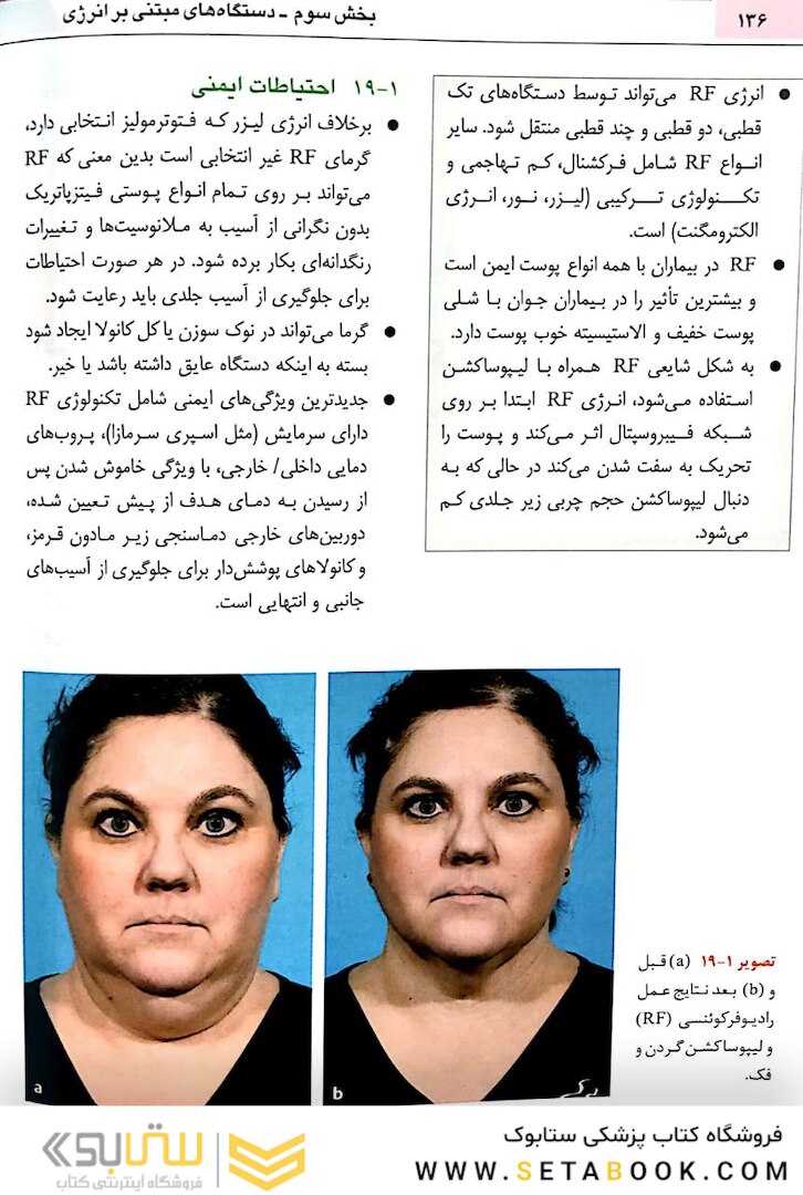 نواحی خطر صورت در پروسیجرهای زیبایی