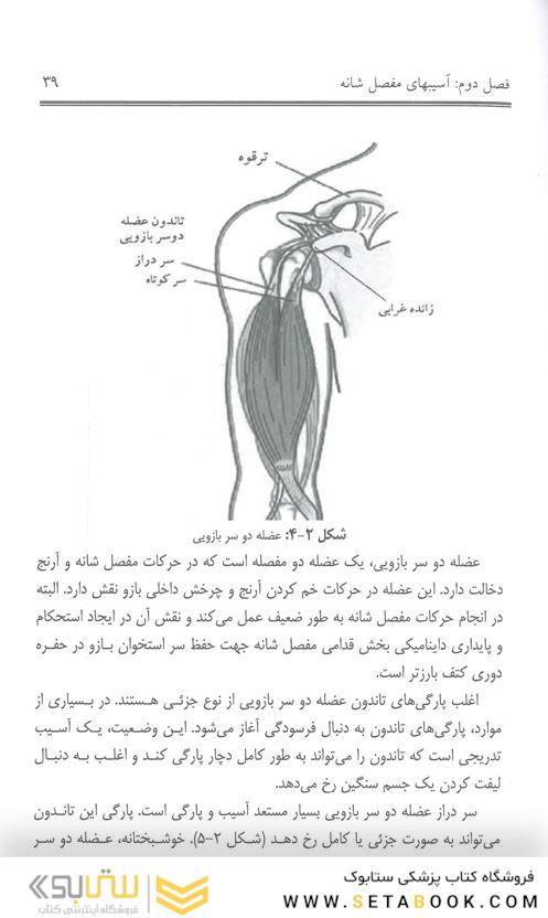 شانه مفصل بی ثبات