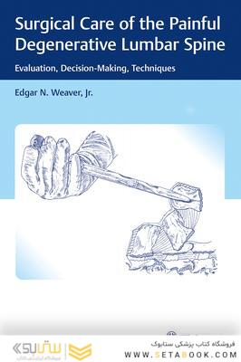 Surgical Care of the Painful Degenerative Lumbar Spine : Evaluation, Decision-Making, Techniques