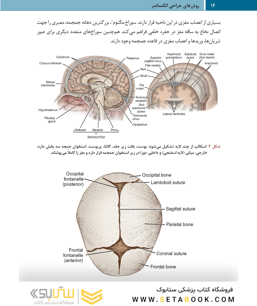 روش های جراحی الکساندر جراحی اعصاب