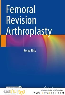 Femoral Revision Arthroplasty